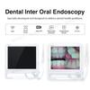 Ultra HD Dental Endoscope Dental Chair Combo: All-in-One Oral Examination and Photography Machine
