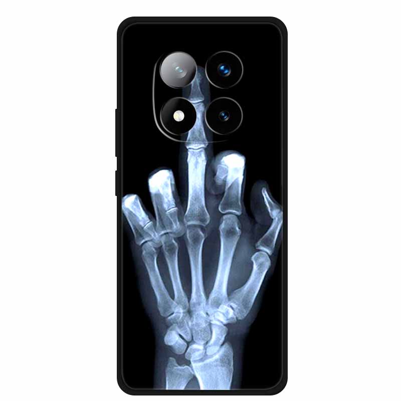 For Redmi Note 14 Pro+ Case Animals Soft Silicone TPU Phone Cases Back Cover For Redmi Note 14 Pro Plus 5G Wolf Shockproof Capa