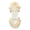Transparent Dental Implant Pathological Model Implant Disease Teeth Model for Teaching Demonstration