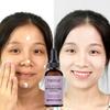 5G/15G/30G/50G/Correction of Dark Spots Face Cream, Lightening Pigmentation, Reducing Age Spots