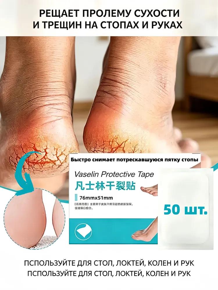500pcs waterproof and breathable wound stickers