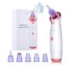 Electric Black Head Removal Face Vacuum Blackhead Instrument Blackhead Remover Vacuum Pore Cleaner