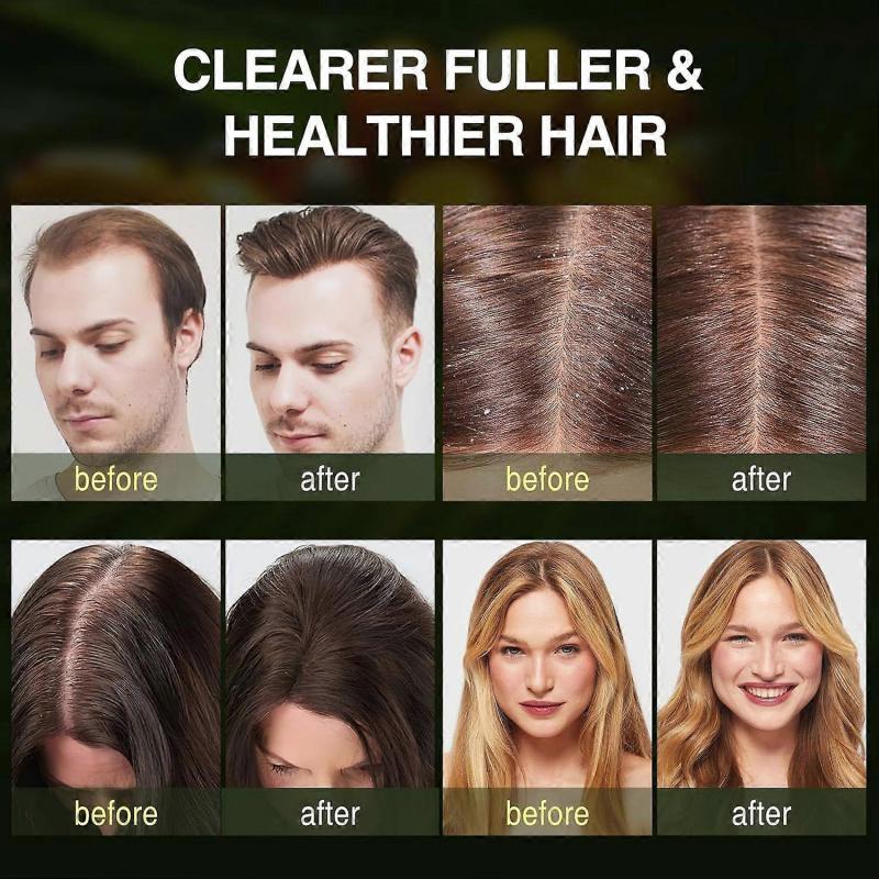 Batana Oil Shampoo for Hair Growth, Strengthening Regrowth Shampoo for Men & Women with Thinning Hair & Hair Loss, Infused Rosemary, Mint Oil Nourishe