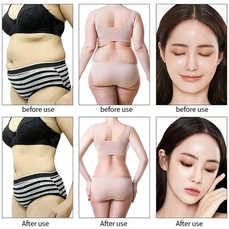 9-in-1 Professional Beauty Device RF Skin Lifting Cavitation Body Contouring Equipment
