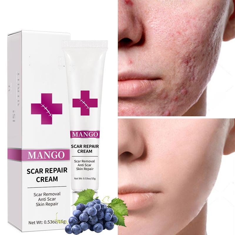 Gentle Scar Removal Paste, Scar Repairing Diminishing Skin Scar Gel, Scar Reduce Paste For All Skin Types