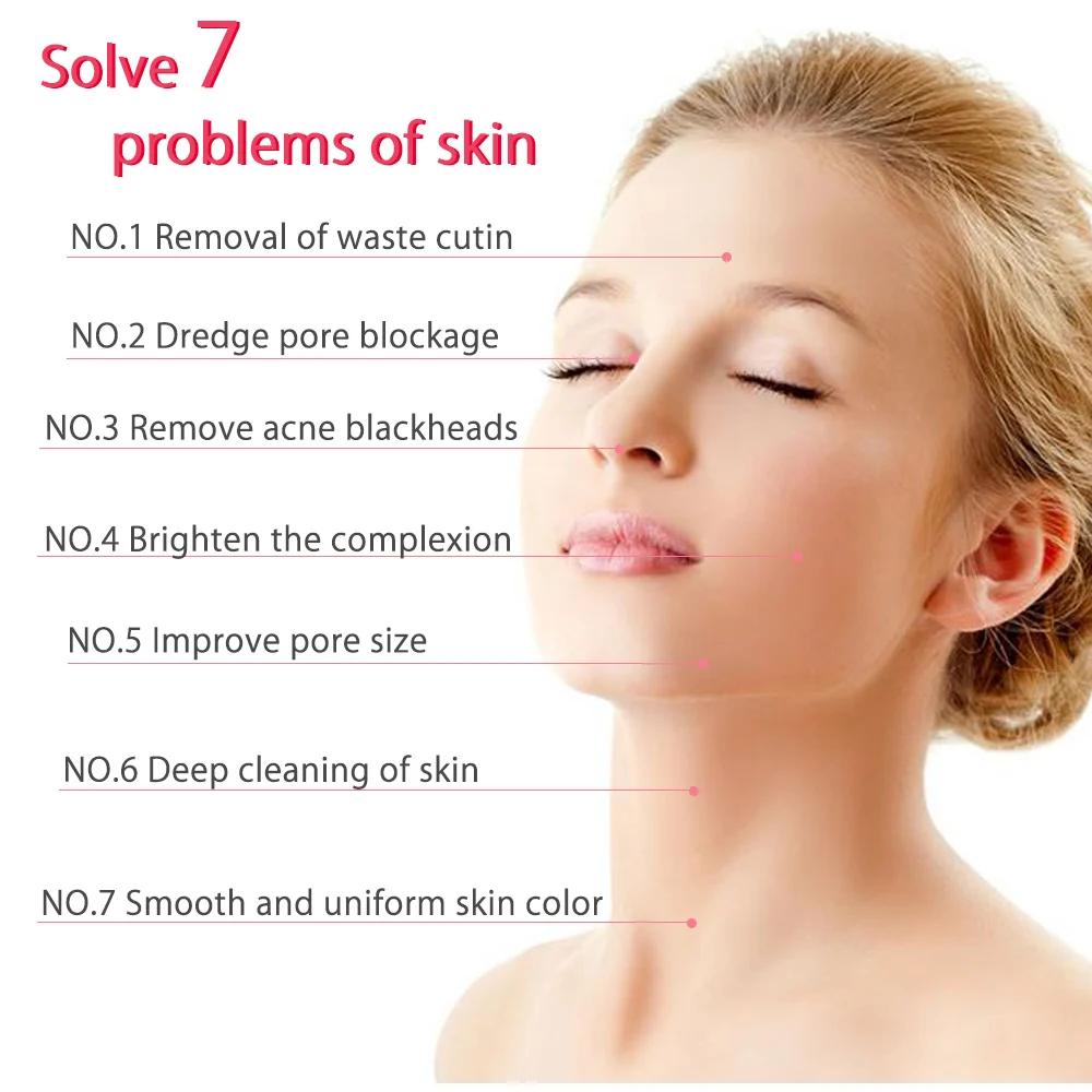 3 w 1 Urządzenie do mikrodermabrazji diamentowej Wysoka moc ssania Profesjonalna dermabrazja do użytku domowego Peeling twarzy Urządzenie do pielęgnacji skóry