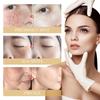 Eelhoe Brightening Cream With Bearberry Extract For Moisturizing And Spot Reduction
