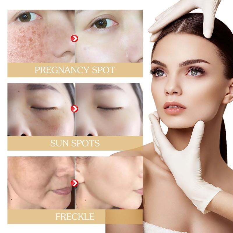 Eelhoe Brightening Cream With Bearberry Extract For Moisturizing And Spot Reduction