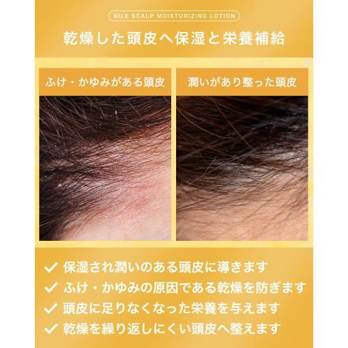NILE Scalp Moisturizing Lotion Dandruff, Itching, Dryness