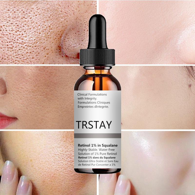 Moisturizing Face Cream, Repair Dry Skin, Make Skin Delicate And Tender, Suitable For All Skin Types, And Make Your Skin Look Younger