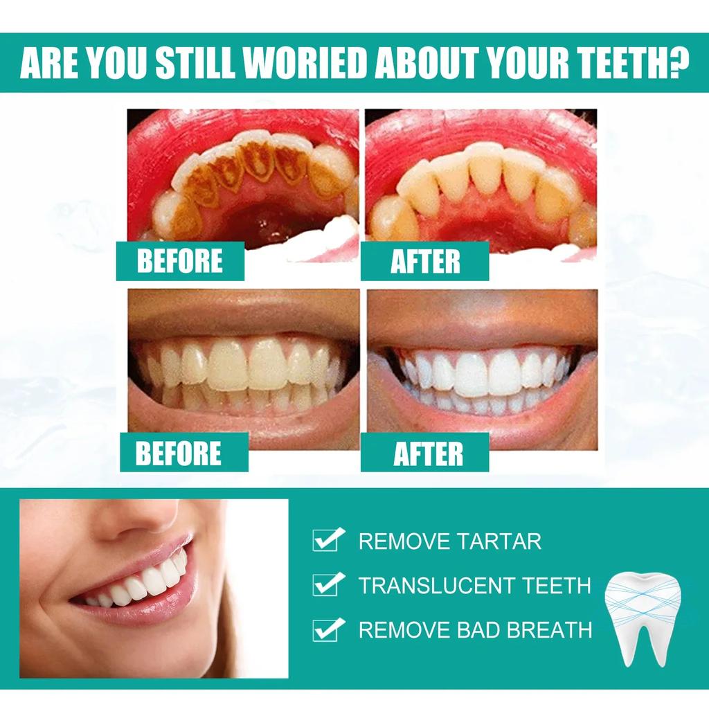Rimozione Tartaro Dentale Spray Sbiancante Denti Dentifricio Pulizia Igiene Orale Rimozione Alitosi Placca Macchie Cura Alito Fresco 1/2/3 PZ