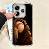 Baseball Sport Plating Phone Case For Xiaomi Redmi Note 14 15 Pro Plus 13 12 11 11S 11T 10 9S 9 5G Anti-Fall Airabag Cover
