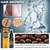 Hair Growth Serum Anti Loss Regrowth Hair Growth Oil Prevent Baldness Repair Damage Scalp Massage Moisturizing Nourish Hair Care