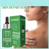 Ouhoe Scar Repair Serum For Smooth Skin Reduces Scars From Surgery And Pregnancy 30ml