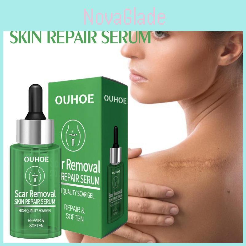 Ouhoe Scar Repair Serum For Smooth Skin Reduces Scars From Surgery And Pregnancy 30ml
