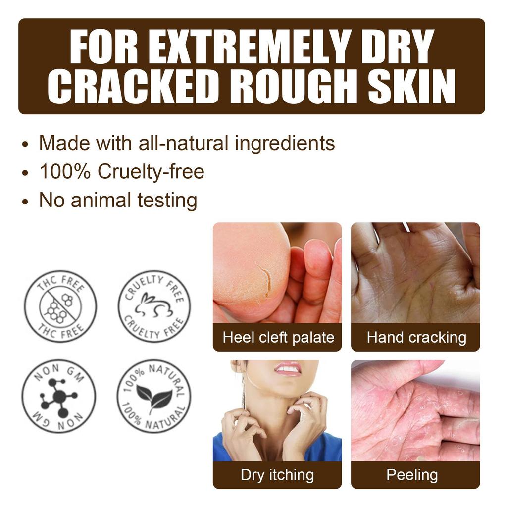 15g Cracked Heel Treatment Cream Repairing Feet Anti-Dry Cracked Peeling Chapped Moisturizing Foot Cream