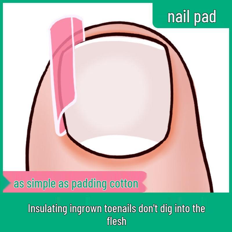 Ingrown Toenail Correction Pad – Orthopedic Sticker for Toenail Relief