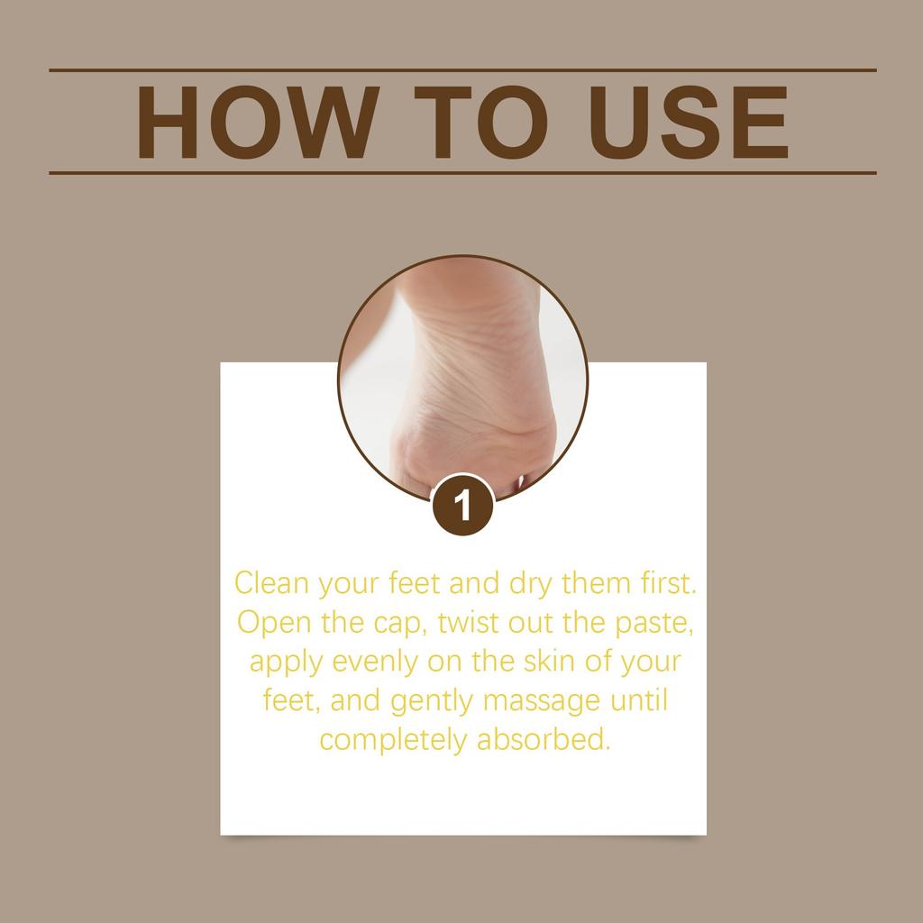 Urea Cream, Foot Balm Sticks Dryness, And Foot Moisturizing Sticks Improve Chapping And Roughness