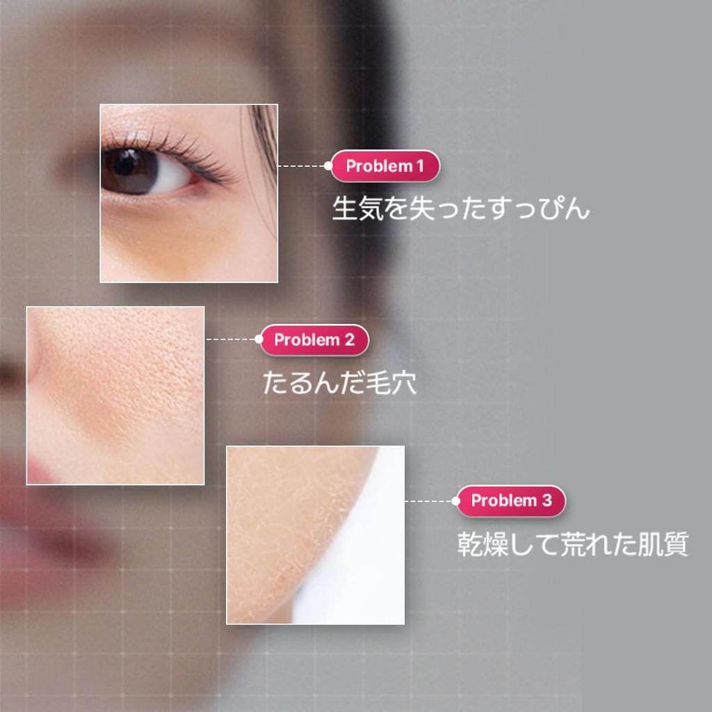 MEDIHEAL OFFICIAL Rose PDRN Essential Mask Pore Moisturizing Skin Care (10 Sheets) - Care, Serum-Rich,