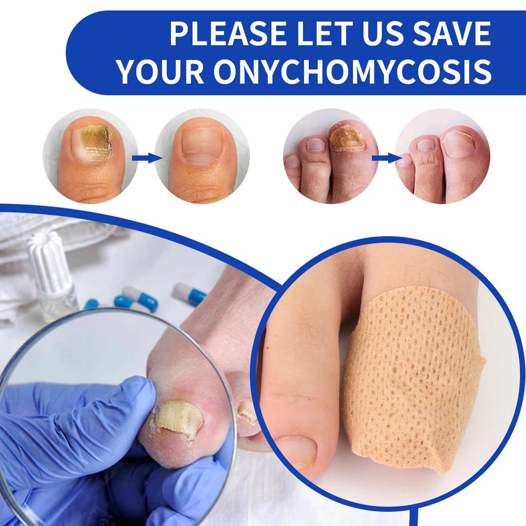 21 ks Náplasti na plíseň nehtů Vodotěsné náplasti na opravu nehtů Nálepka na korekci zarostlých nehtů Péče o poškozené šedé nehty Nástroje pro péči o nohy