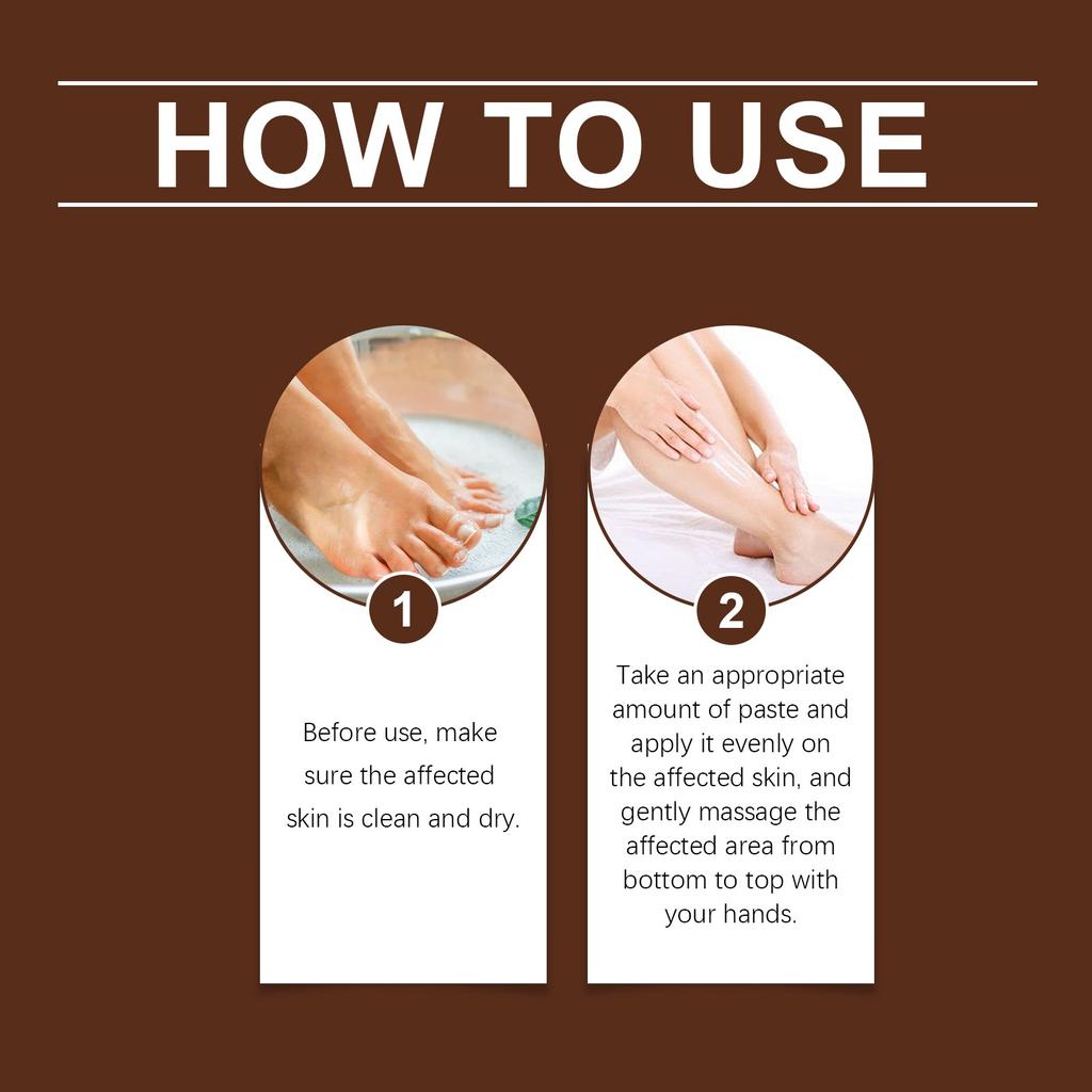 Leech Varicose Care Cream;Varicose Vein Cream For Legs;Varicose Veins MiracleCream