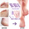 Exfolia Foot  Pedicure Socks Exfoliation for Feet Mask Remove 10ML