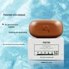 Manting Anti-Mite Oil Control Acne Soap