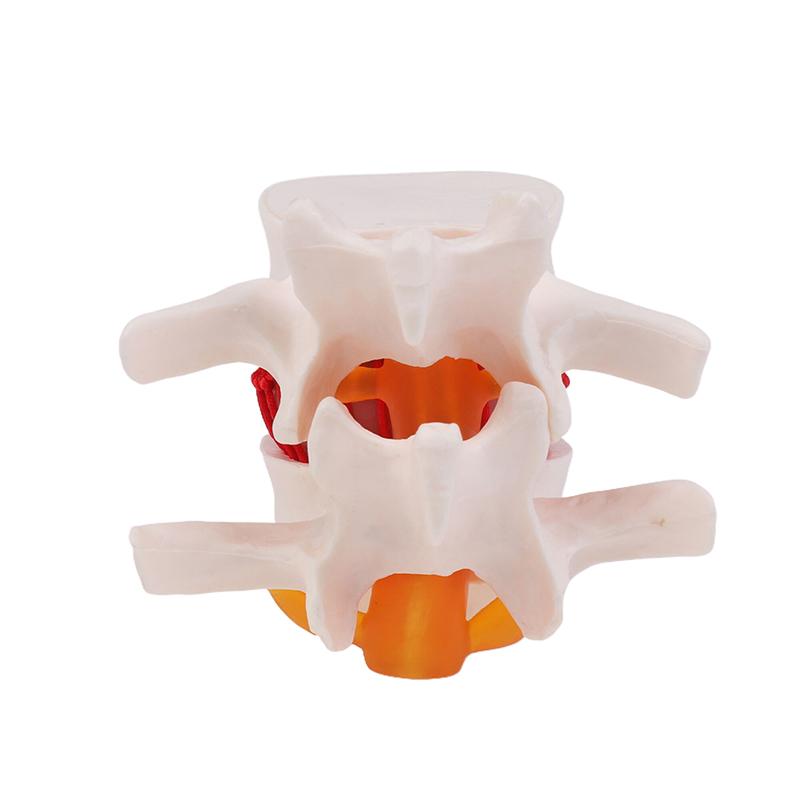 Menselijke Anatomie Skelet Wervelkolom Hernia Lumbalis Onderwijsmodel Hersenen Schedel Traumatisch Schoolbenodigdheden Medisch Instrument