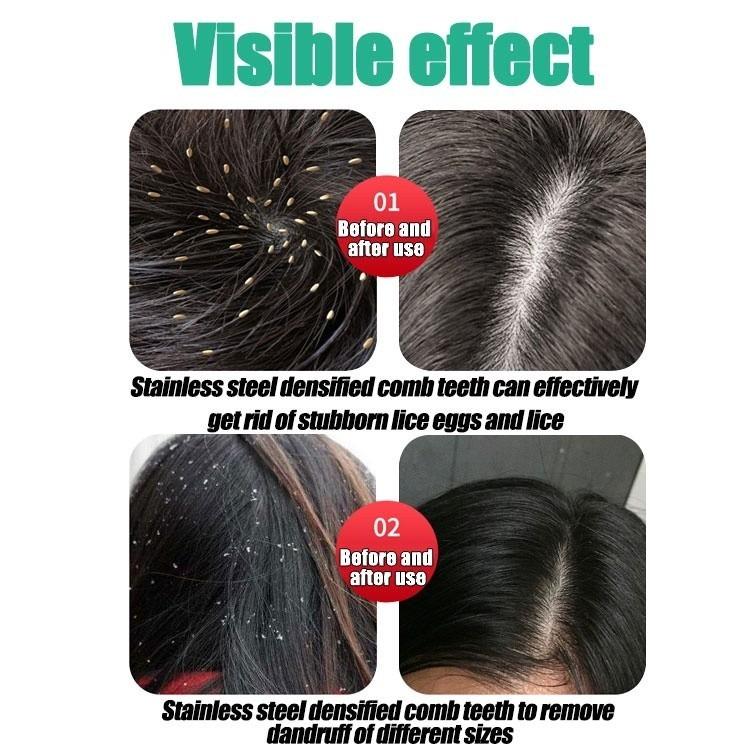 Remove Lice Comb Painless Comfortable Hair Health Black Steel Comb