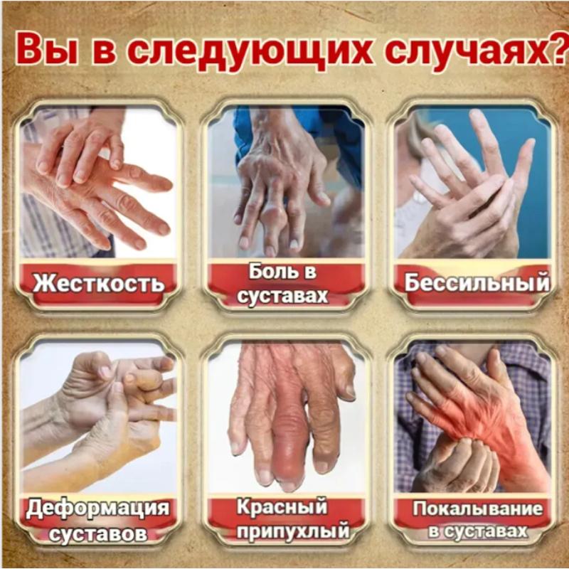 Topical Ointment for Wrist & Finger Arthritis