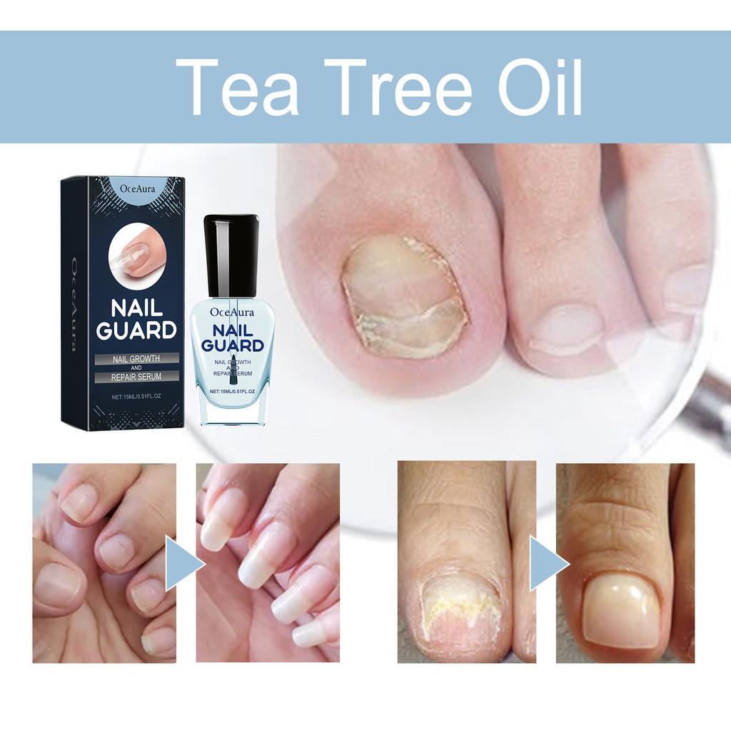 Oceaura Ongle Liquide Réparateur Exceptionnel Pour Nourrir Et Réparer Les Ongles Faibles 15ml