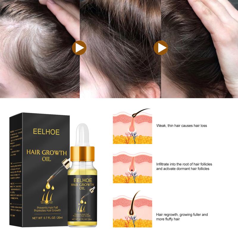 Fast Hair Growth Serum Hair Regrowth Essential Oil Anti Hair Loss Repair Damaged Scalp Women Men Anti Baldness Hair Growth Care