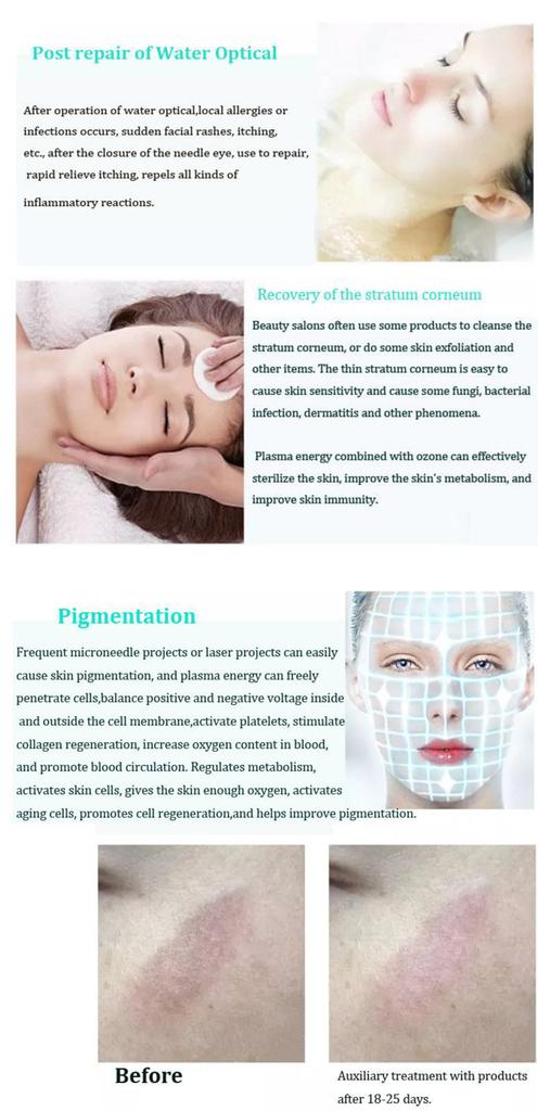 Profesionální ozónové plazmové pero pro zmírnění stárnutí pleti, omlazení pleti, bělení, léčbu akné, plazmové pero