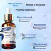 Layanana Fungal Infection Treatment