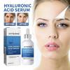 Hyaluronic Acid Serum - Hydrating, Anti-Wrinkle, Skin Firming, Anti-Aging & Moisturizing Essence-Women's Gift