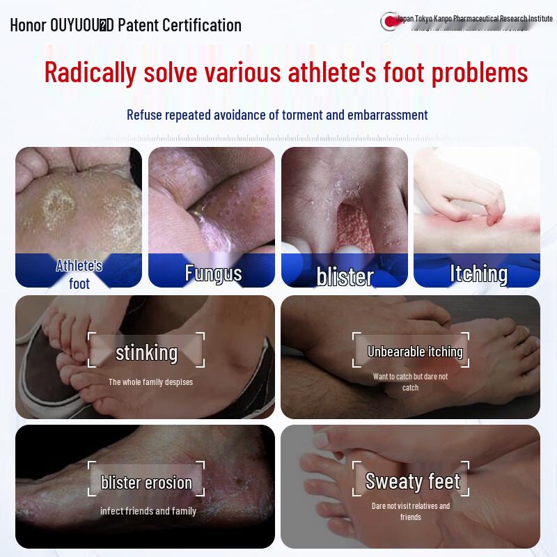 Yu Ou Athlete's Foot & Odor Relief Spray