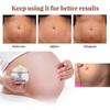 3x Stretch Marks Removal Cream Fat Growth Streaks Maternity Scars Acne Repair Increase Skin Elasticity Anti-wrinkle Firm Body Care