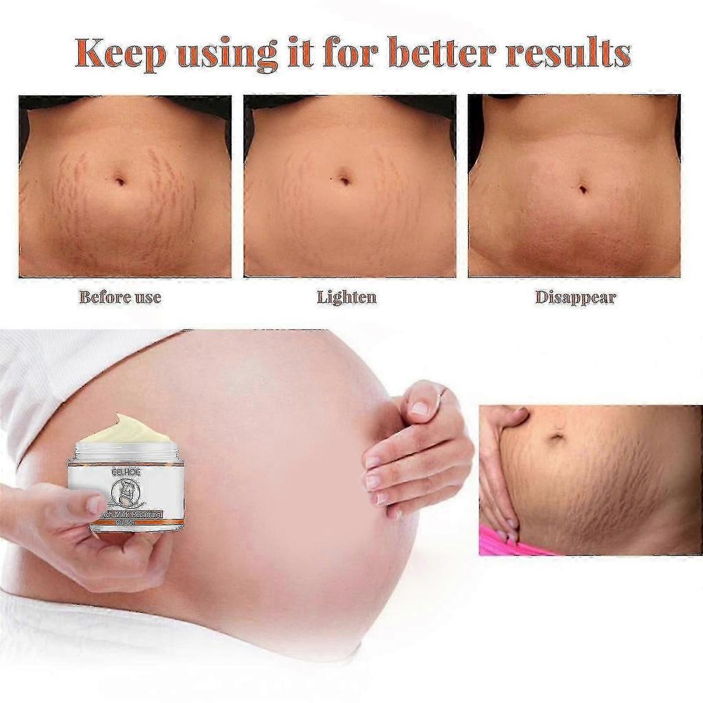 3x Stretch Marks Removal Cream Fat Growth Streaks Maternity Scars Acne Repair Increase Skin Elasticity Anti-wrinkle Firm Body Care