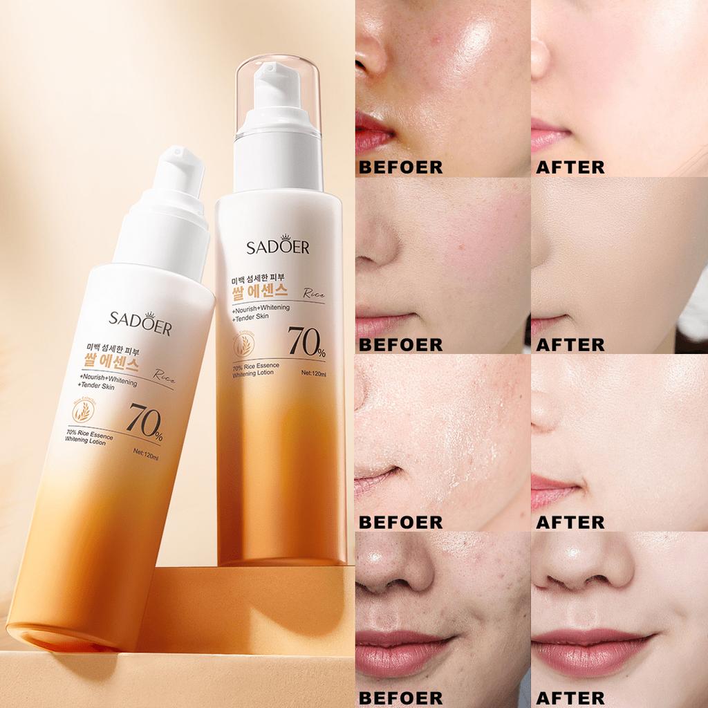 1 Bottle 120ml Rice Essence Moisturizing Lotion, Long-Lasting Hydration, Enhances Skin Radiance, Sil