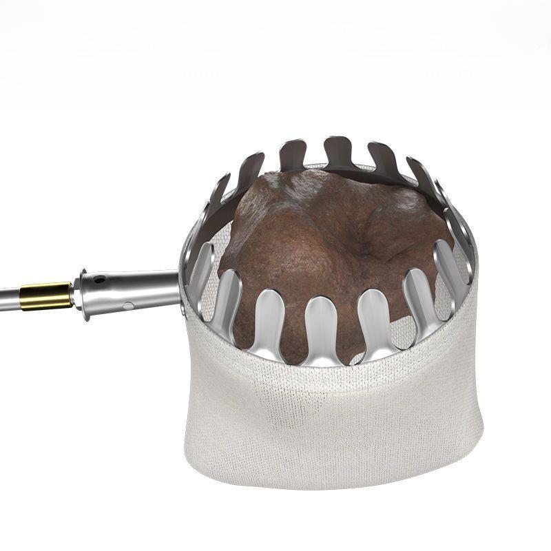 High-Altitude Fruit Picker: Loquat, Waxberry, Mango, Plum, Peach, Apricot - Telescopic Pole Tool