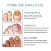 Ximonth Nail Care Kit - Repair And Thickening Soft Nail Care For Ingrown Nails, Hand And Foot Nail Fungus Treatment Kit
