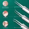 Ultra-Fine Tweezers Blackhead & Pimple Extraction Needle Set – Pointed Tip Beauty Tool for Acne Treatment