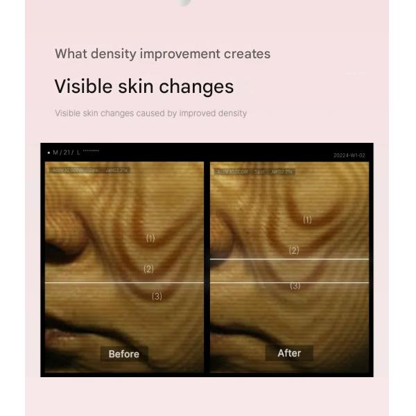 Medicube Collagen Glow Booster Serum 15ml (3 Optionen)