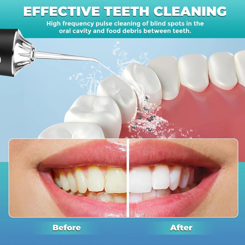 Smart Portable Waterproof Electric Water Flosser for Teeth Cleaning