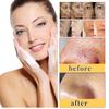 Kojic Acid Soap for Face and Body, Cleansing Bar for Rough Skin