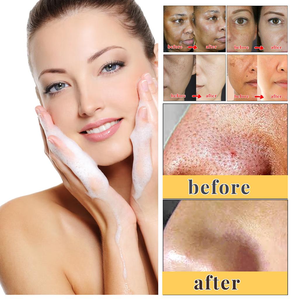 Kojic Acid Soap for Face and Body, Cleansing Bar for Rough Skin