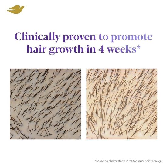 Dove Scalp + Hair Therapy Density Boost Revitalizing Scalp Serum with active ingredients 2.5% Niacinamide and 1.5% Zinc-peptides