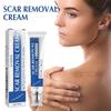 1-3x Acnes Scars Removal Cream Effectiveness Non-irritating Cream For Face