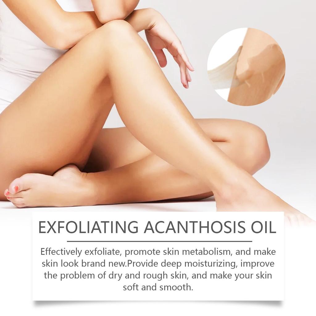 Ouhoe Gentle Exfoliating Body Oil For Underarm Elbows And Joint Darkening Treatment