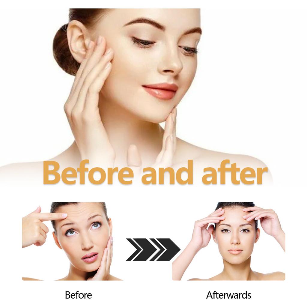 Hoygi Collagen Anti-wrinkle Serum For Deep Hydration And Skin Firming 30ml